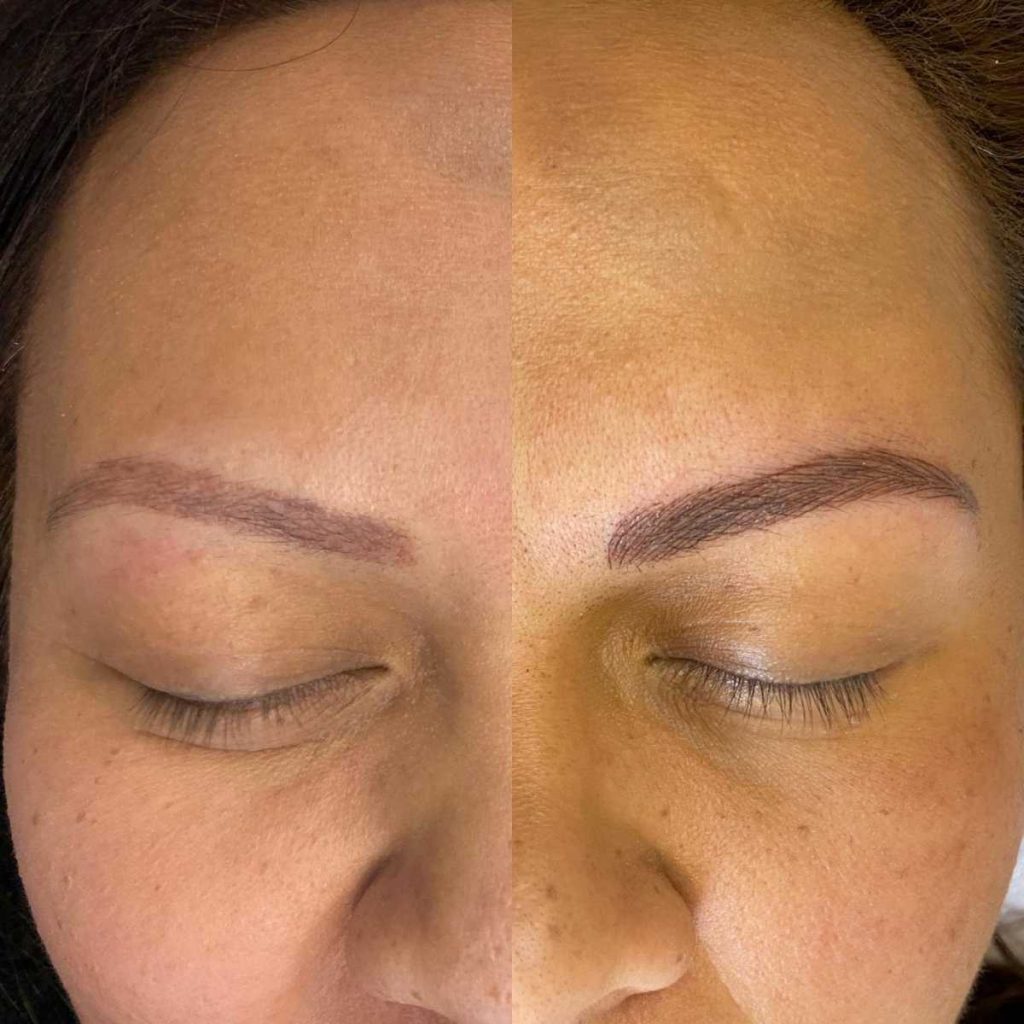Alopecia Tattoo Treatment in Karachi – Scalp Micropigmentation at Devil Tattoo Studio