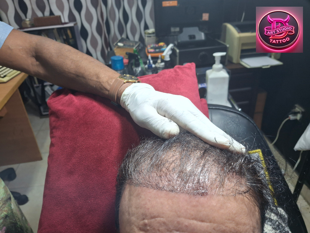 Beard Micropigmentation artist marking natural hairline design in Lahore studio